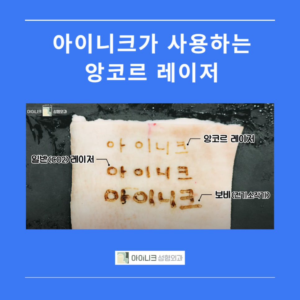 눈밑지방성형외과 찾기 어렵지 않아요 관련 이미지 2