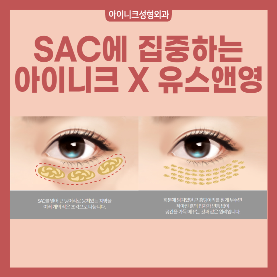 A New Idea! Under-Eye Surgery Center, Youth & Young! image 3