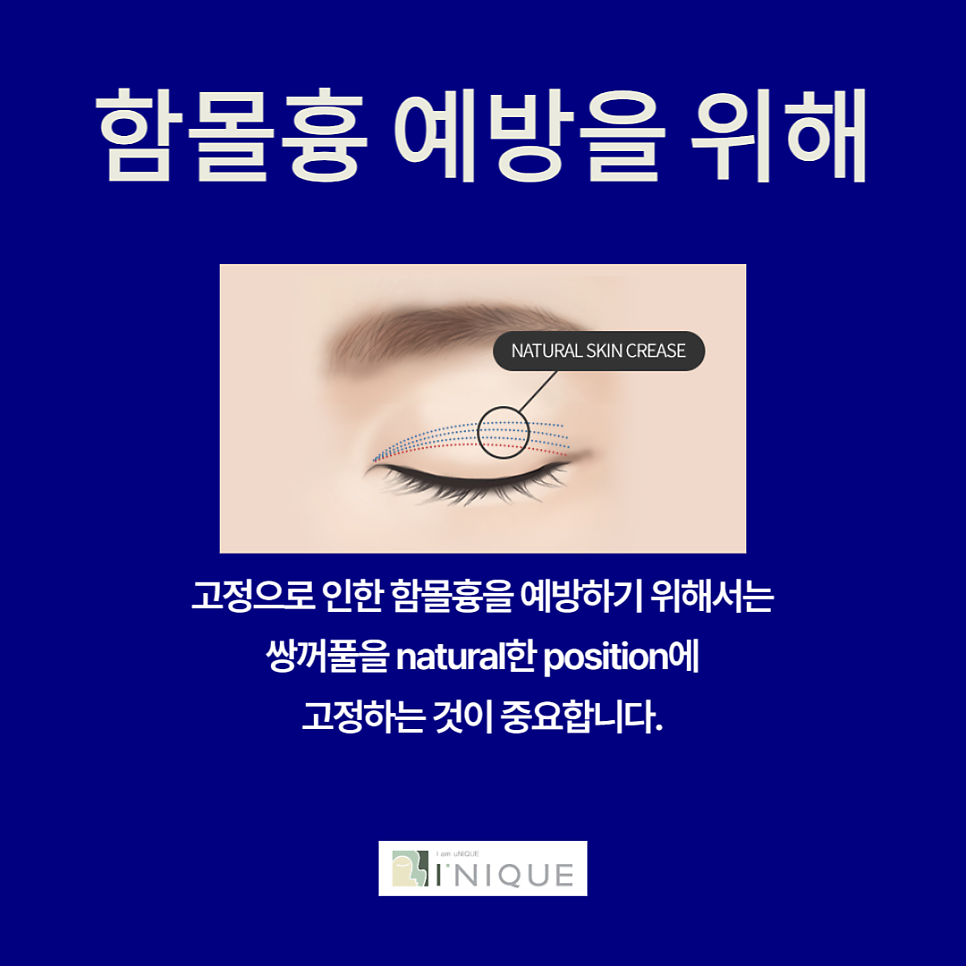 Why Do Double Eyelid Scars Occur? image 5