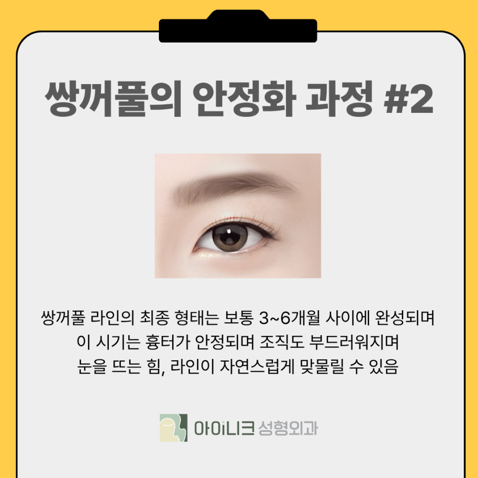 Why Does the Double-Eyelid Line Keep Getting Thinner? image 8