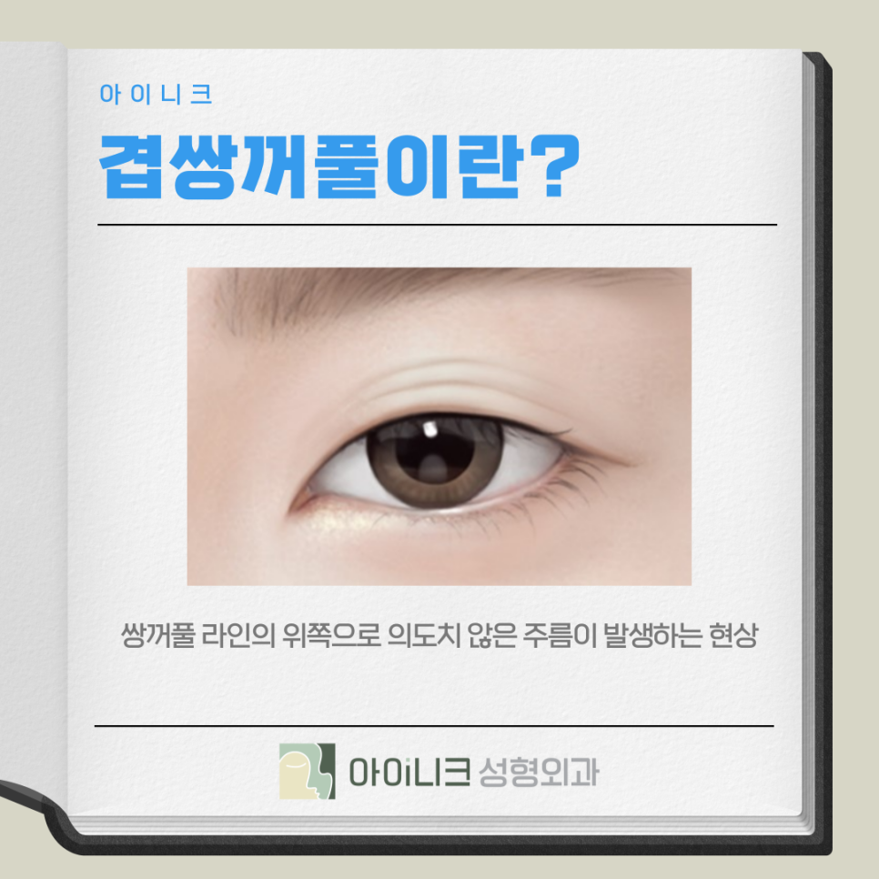 겹쌍꺼풀 여러 개의 주름이 생기는 증상일까요? 관련 이미지 5