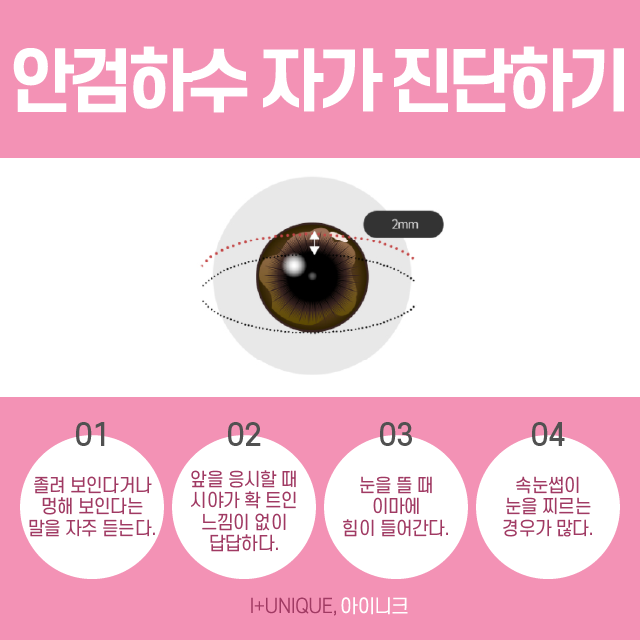 졸린 눈이 고민이라면 졸린눈성형인 눈매교정술로 또렷한 눈으로 거듭나기! 관련 이미지 2