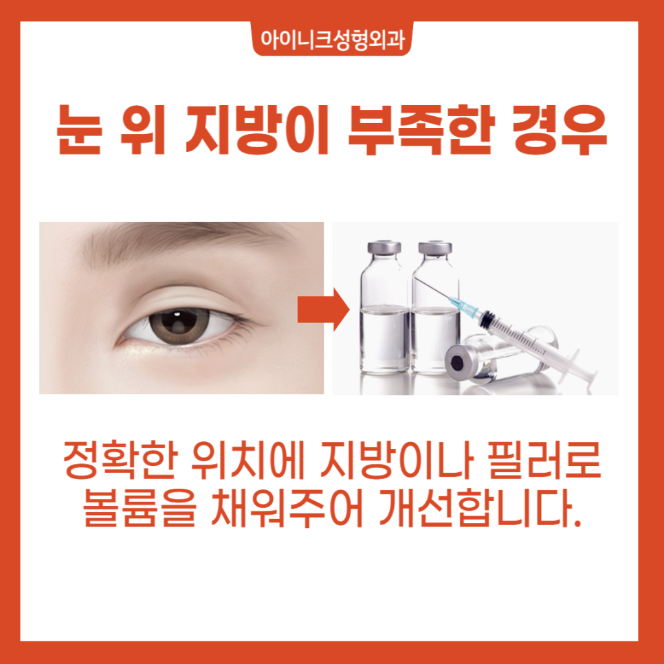 The Best Place for Eyelid Revision Surgery Is Different, Indeed. image 5