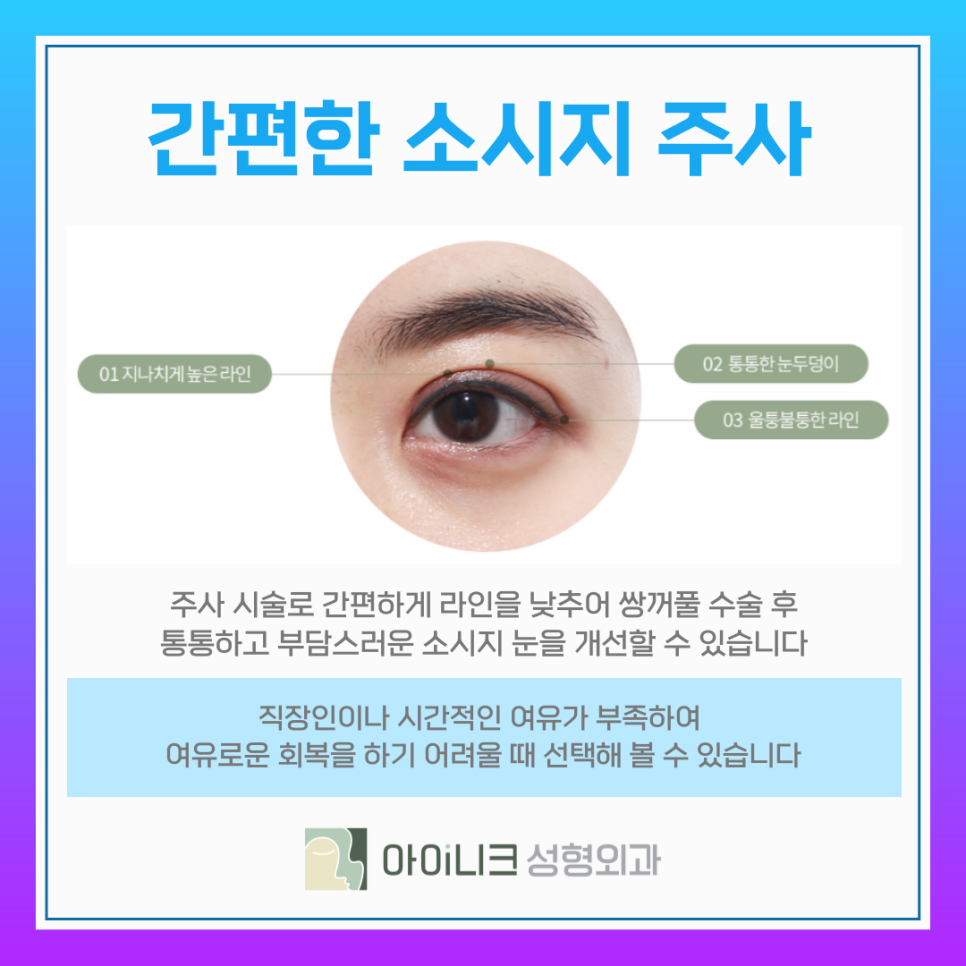 눈재수술비용 보다 중요한 소시지 쌍꺼풀 개선방식 관련 이미지 11