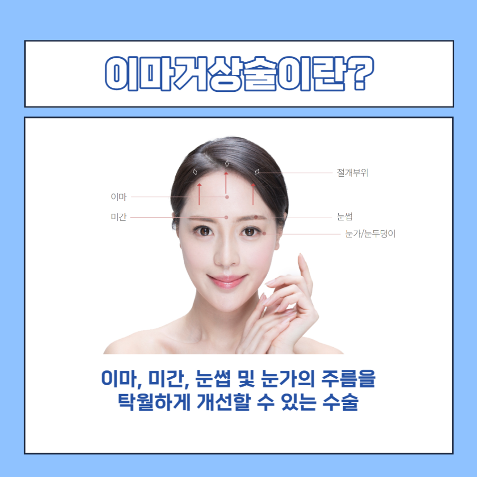 안면거상술잘하는곳 찾는다면 주목하세요! 관련 이미지 2