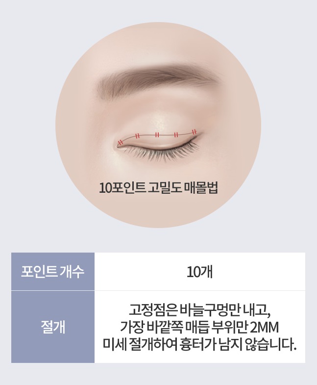 티안나는쌍수 아이니크의 노하우로! 관련 이미지 5