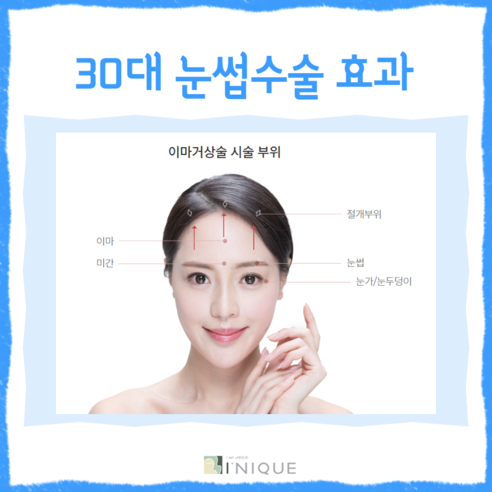 Are you looking for eyebrow surgery for people in their 30s? image 3