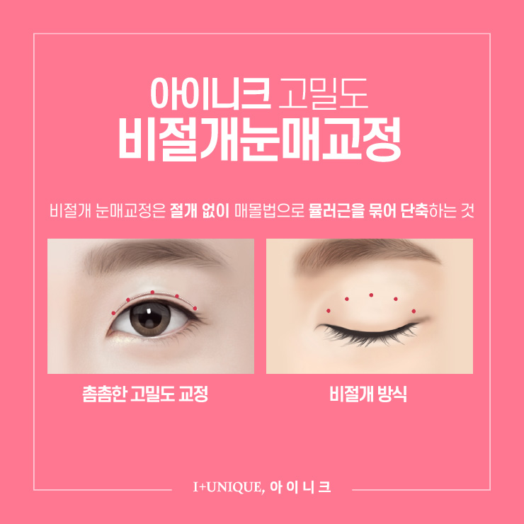 졸린 눈 성형 잘하는 병원 ㅇㅇㄴㅋ 관련 이미지 3