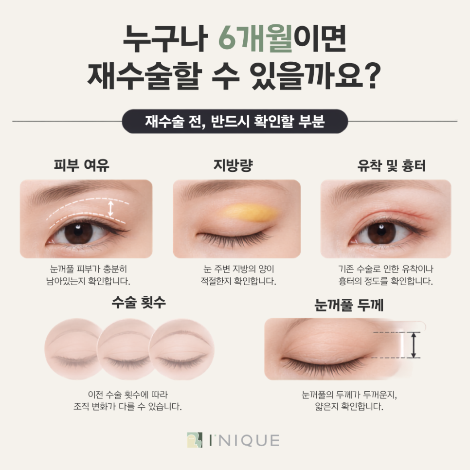 쌍꺼풀재수술잘하는병원, 누구나 6개월이면 재수술할 수 있을까요? 관련 이미지 4