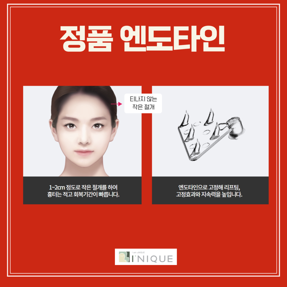 If You Want to Remove Forehead Wrinkles Properly image 4
