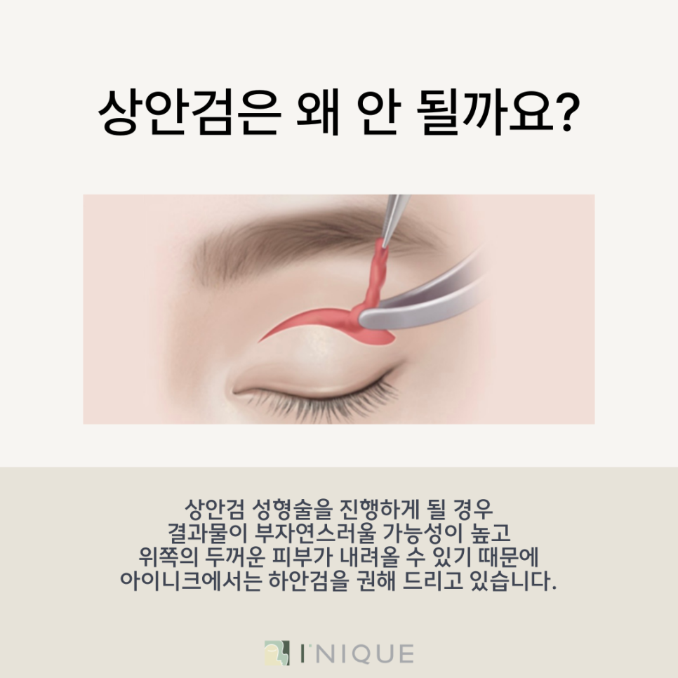 When You're Looking for a Natural Under-Eye Correction image 6