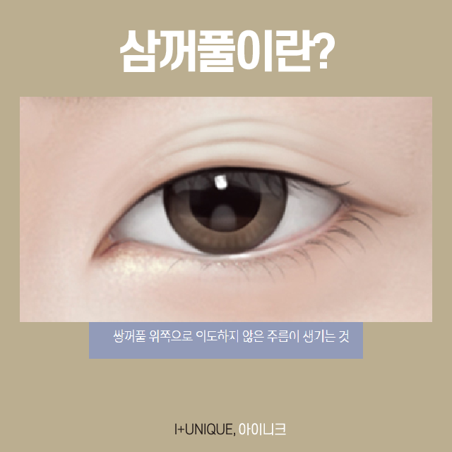 서울눈재수술 성공하고 싶다면? 관련 이미지 4