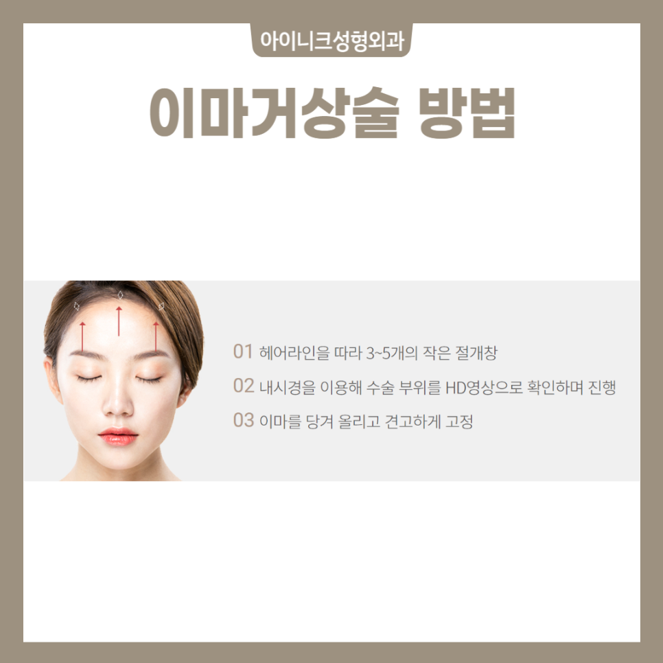 Forehead Lift Effect? If You’re with Iinic, There’s Nothing to Worry About image 4