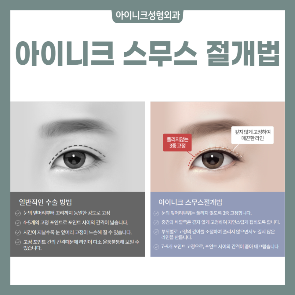 Get Your Blepharoplasty Consultation Done Properly! image 4