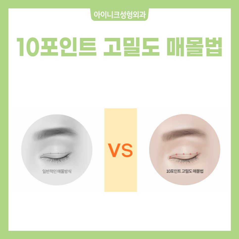Gangnam Eyelid Surgery Recommendation: Where Is Safe and Reliable? image 5