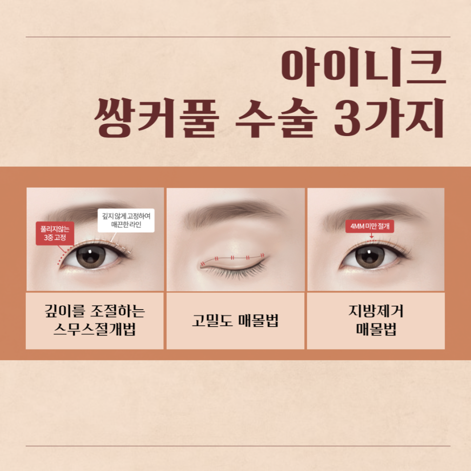 강남눈수술, 이곳이 답! 관련 이미지 2