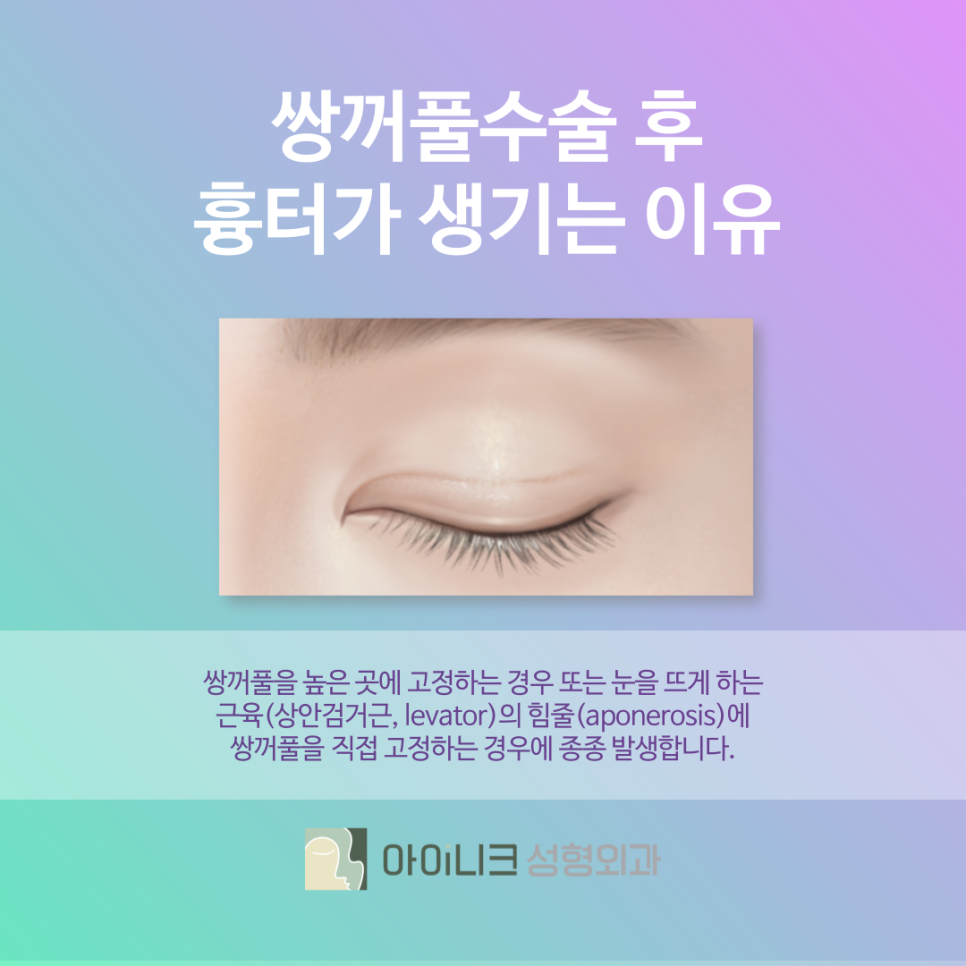 쌍수흉터 유형과 개선하는 방법 관련 이미지 5