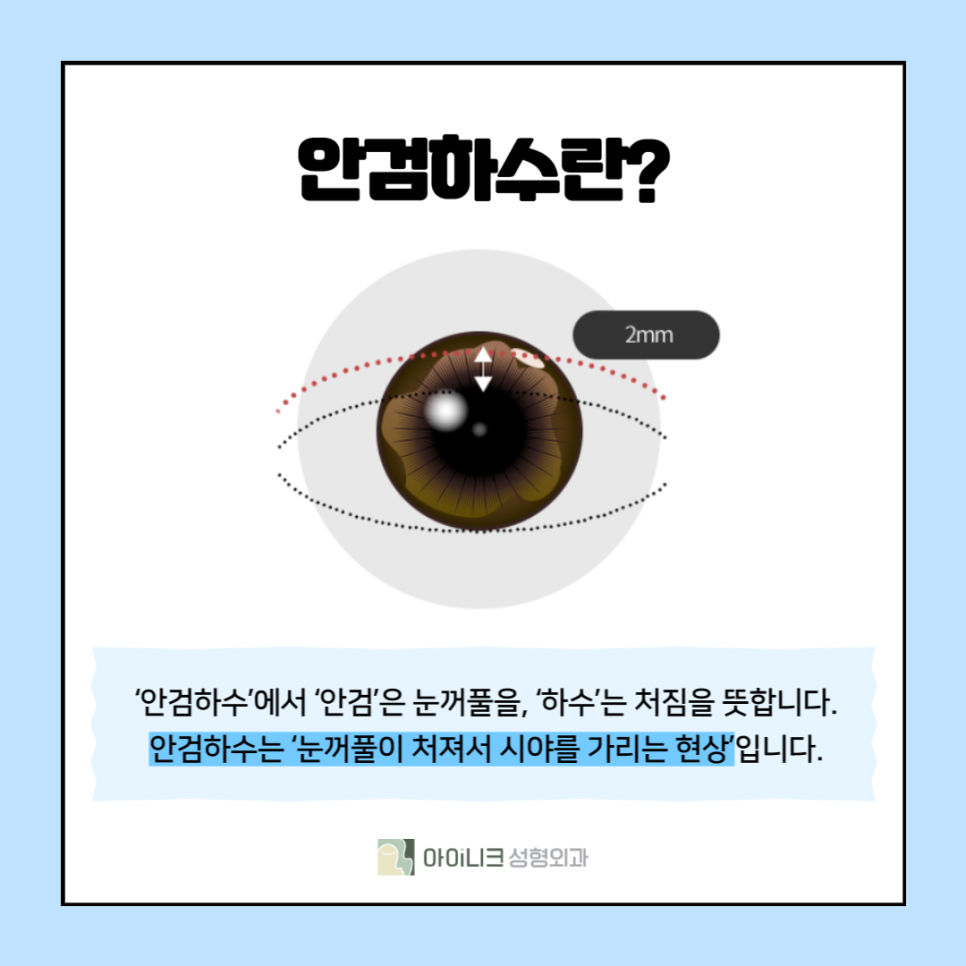 If You're Curious About Eye Correction Surgery Methods? image 2