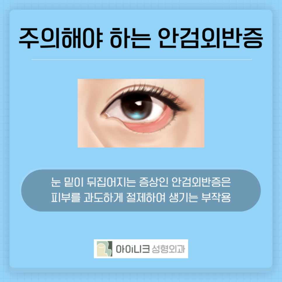 강남역 하안검 잘하는곳 관련 이미지 5