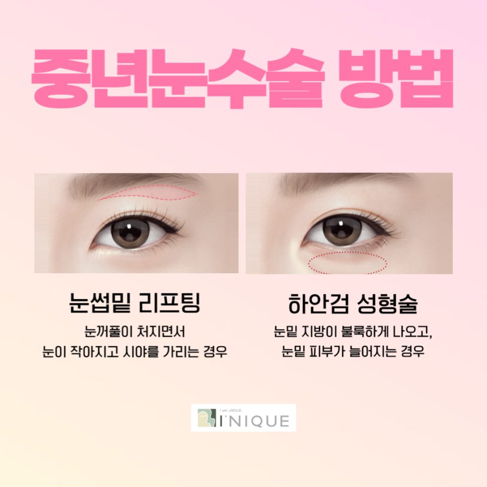 I-NIQUE, a Place Known for Good Middle-Aged Eye Surgery image 2