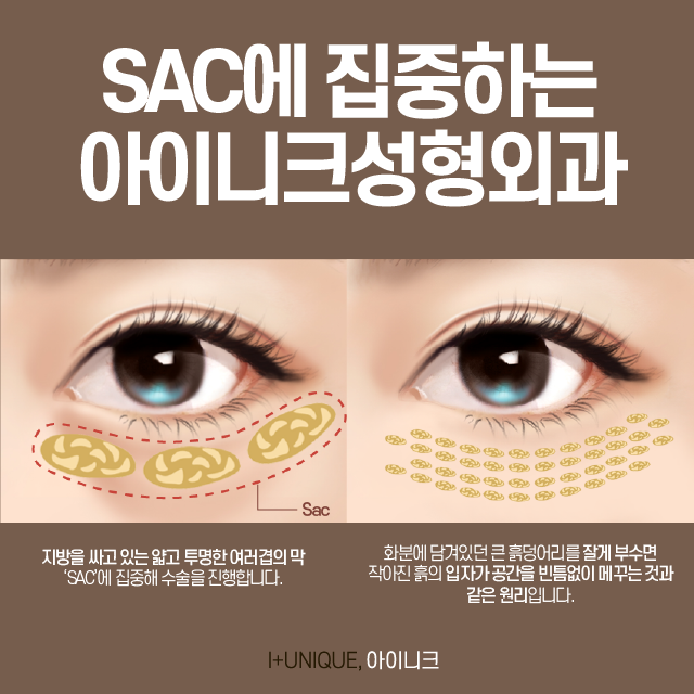 오늘 수술 내일 출근할 수 있는 눈밑지방수술 관련 이미지 2
