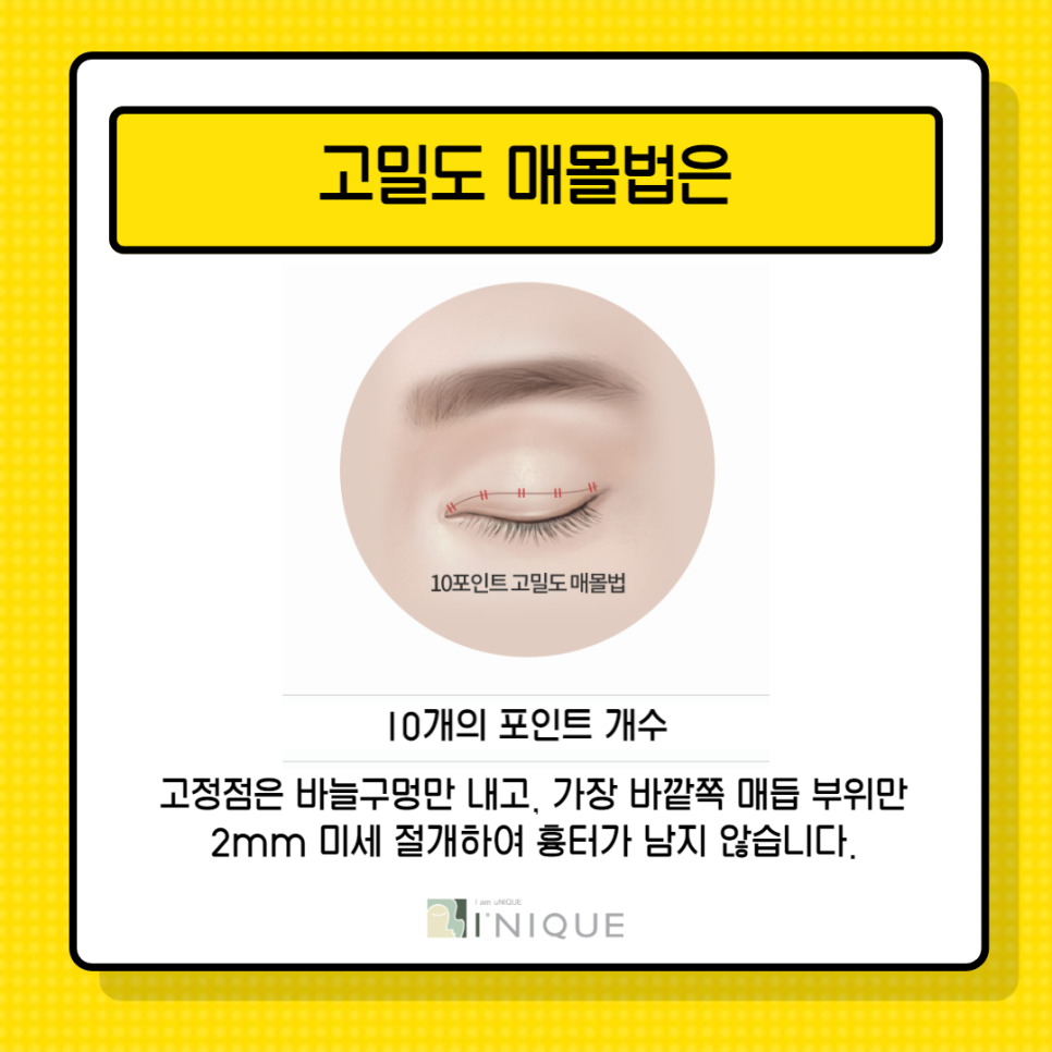 강남쌍수잘하는곳은 뭐가 다를까? 관련 이미지 5