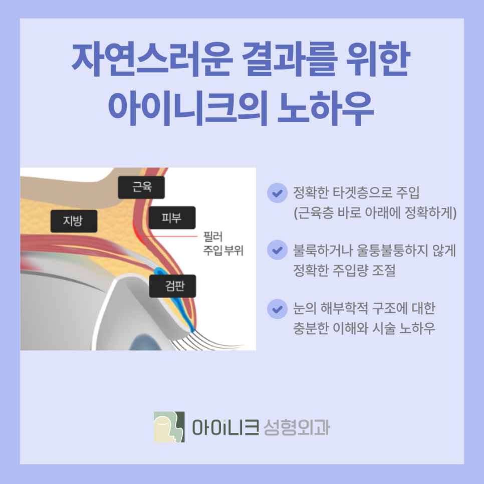 Achieve a Natural Look with Convenient Fillers in Apgujeong image 6