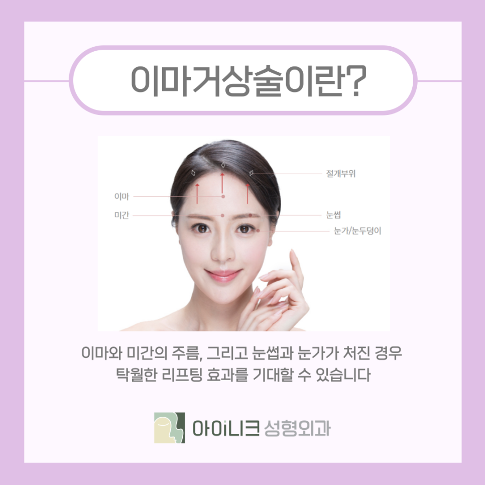 눈가리프팅 이마거상술로 올려주기 관련 이미지 6
