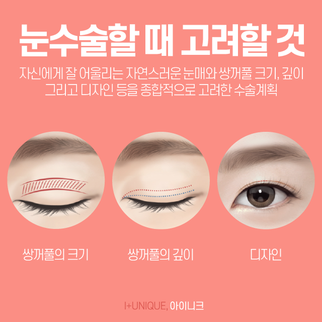 서울눈성형외과 여기는 어떠신가요? 관련 이미지 3