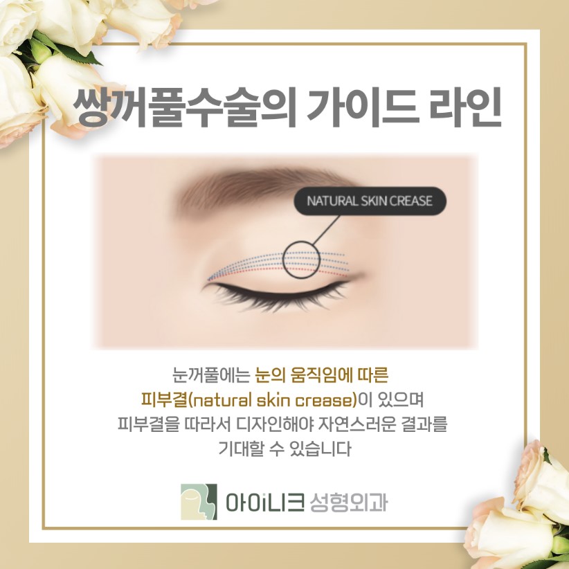 쌍꺼풀종류 자신에게 어울리는 것이 중요! 관련 이미지 10