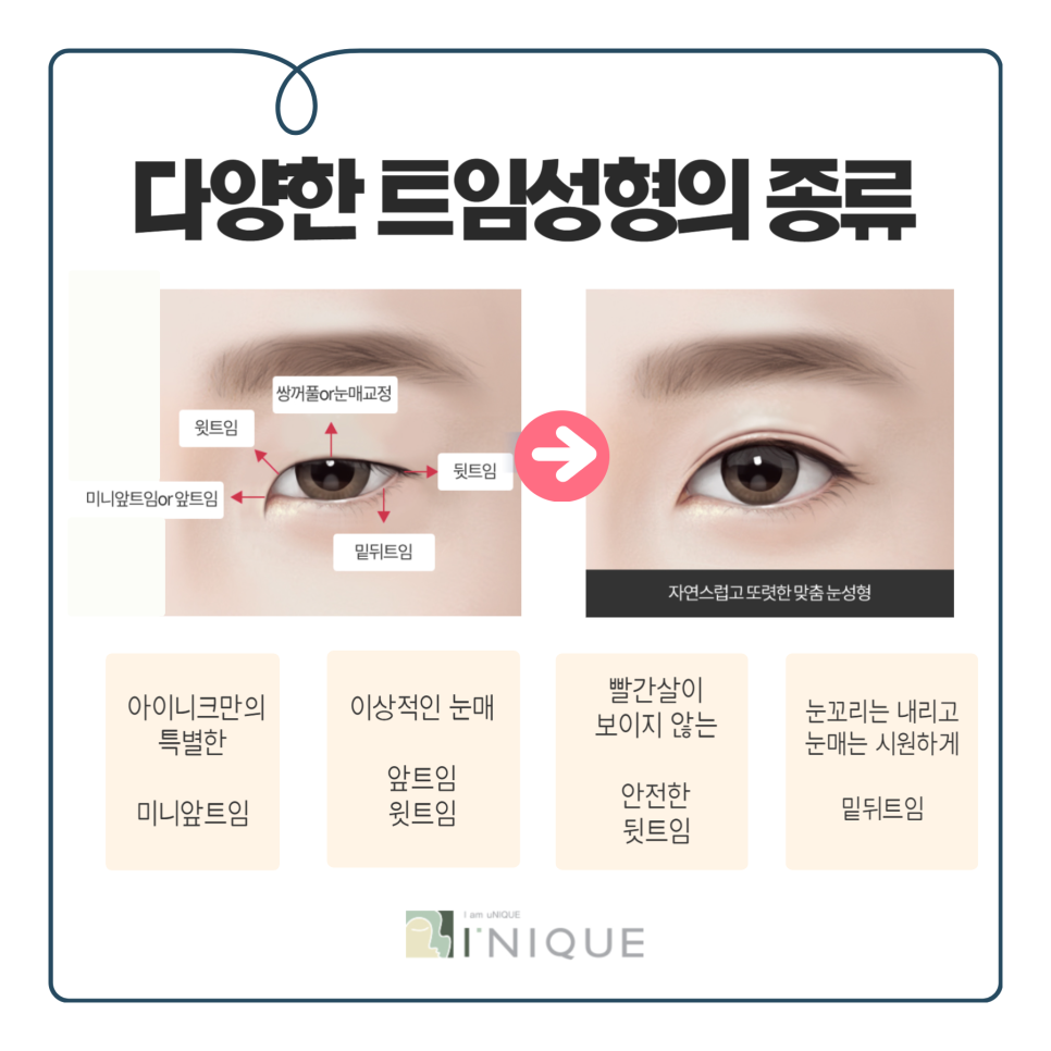 뒤트임잘하는곳 만의 특별함 관련 이미지 2