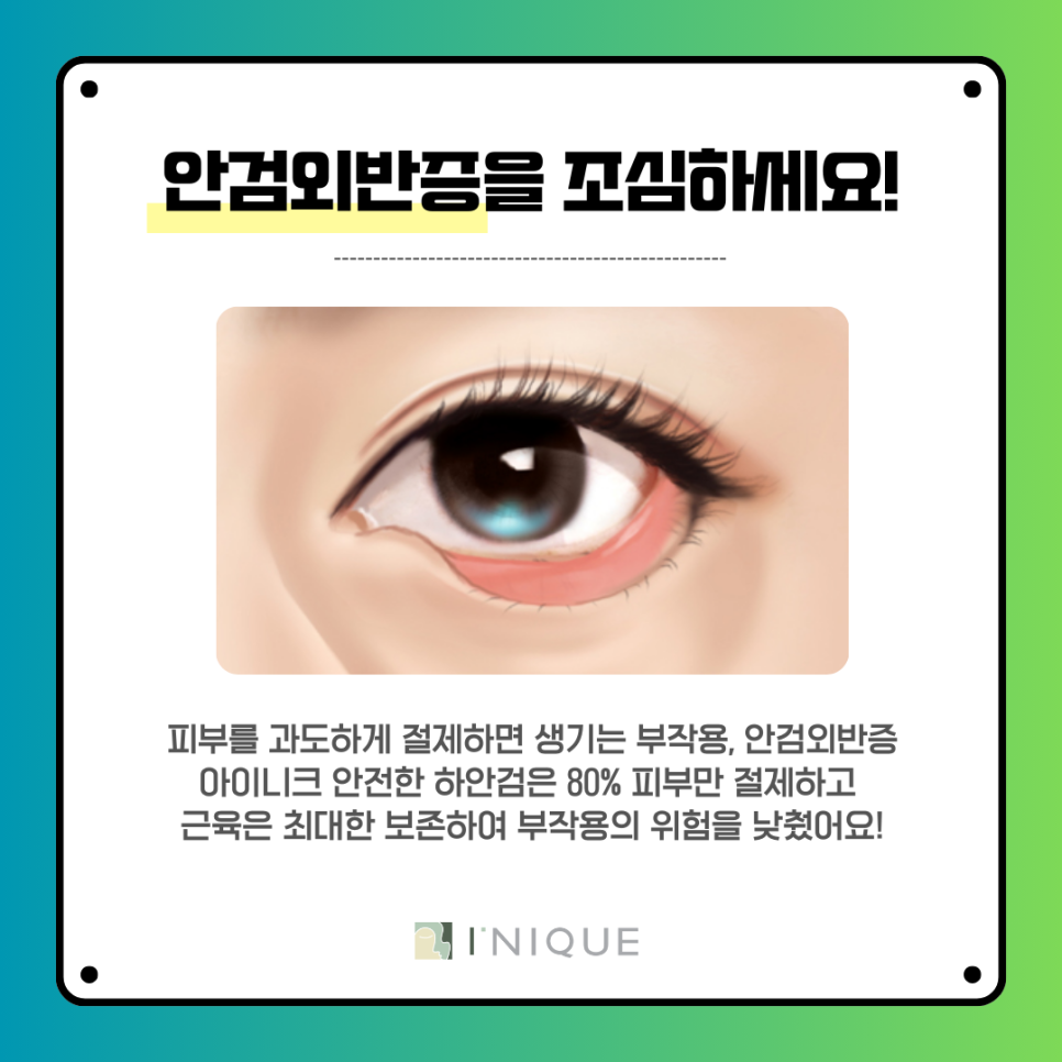 청담동 중년눈성형 정보! 상안검 비추하는 이유 관련 이미지 7