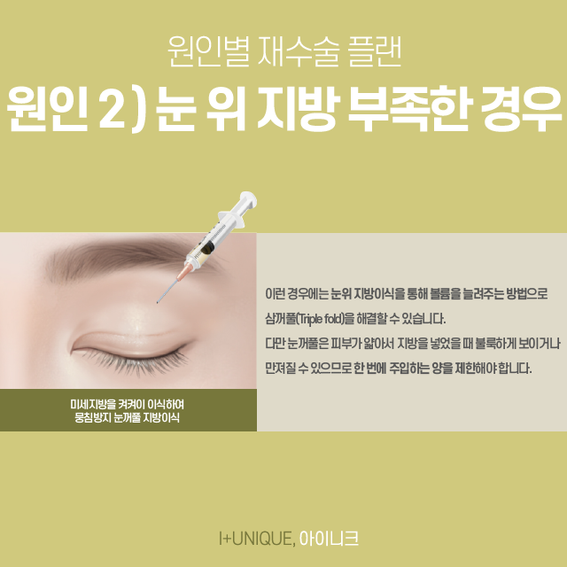 Double Eyelid Revision Surgery, Entrust It to the Best Expert When You Need It Most! image 4