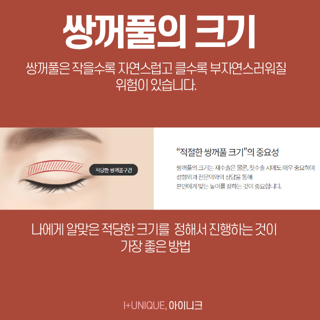 쌍꺼풀잘하는곳에는 다 방법이 있다, 어떤 것이 있을까 관련 이미지 3