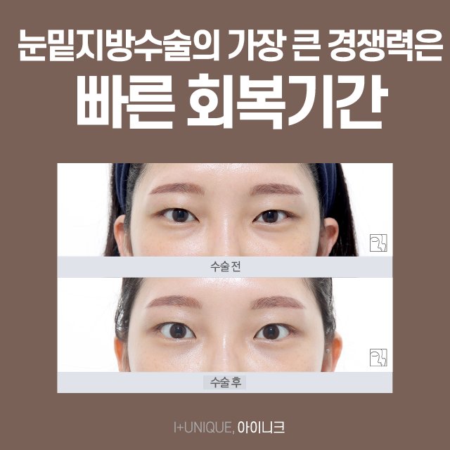 Restore Your Vitality at Inique, a Gangnam Under-Eye Fat Repositioning Clinic! image 3