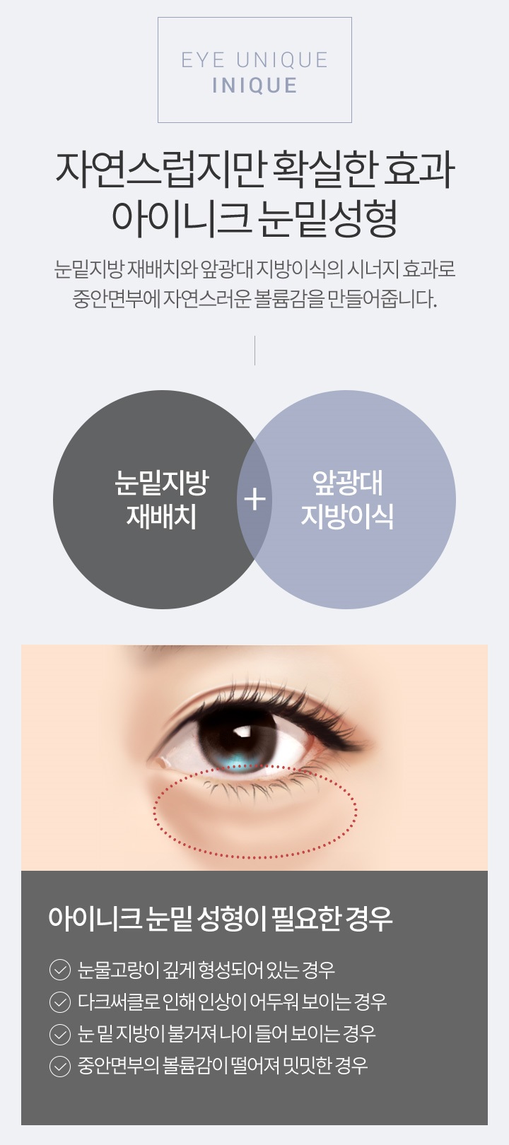 다크서클수술비용이 궁금하다면? 관련 이미지 2