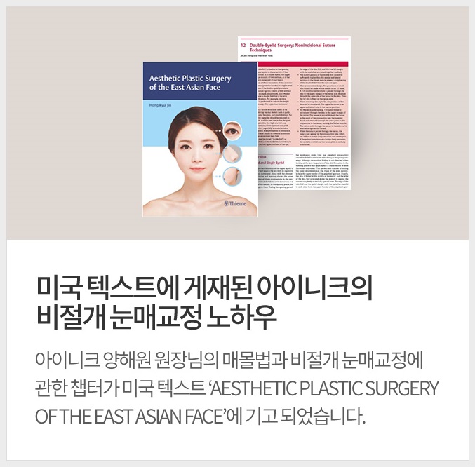 무쌍눈매교정술 쌍꺼풀 없이 큰 눈으로 관련 이미지 5
