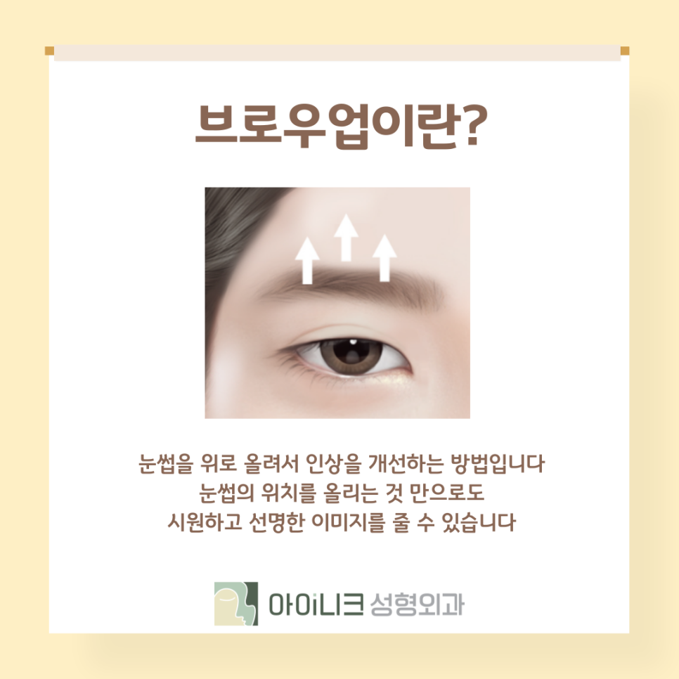 눈썹을 올려 인상을 개선? 브로우업 관련 이미지 5
