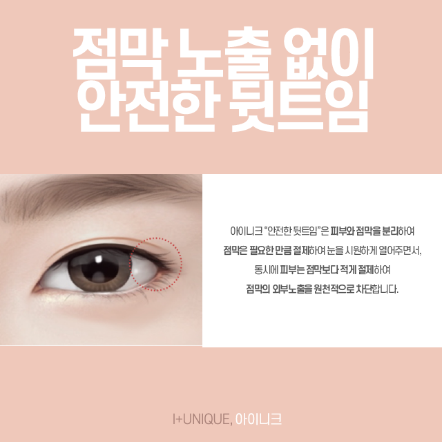 듀얼트임, 듀얼트임가격 한 번에 상담받기! 관련 이미지 4