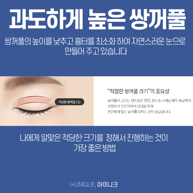 통통해서 부담스러운 내 눈, 쌍꺼풀라인낮추기로 처음부터 내 눈이였던 것처럼 관련 이미지 3