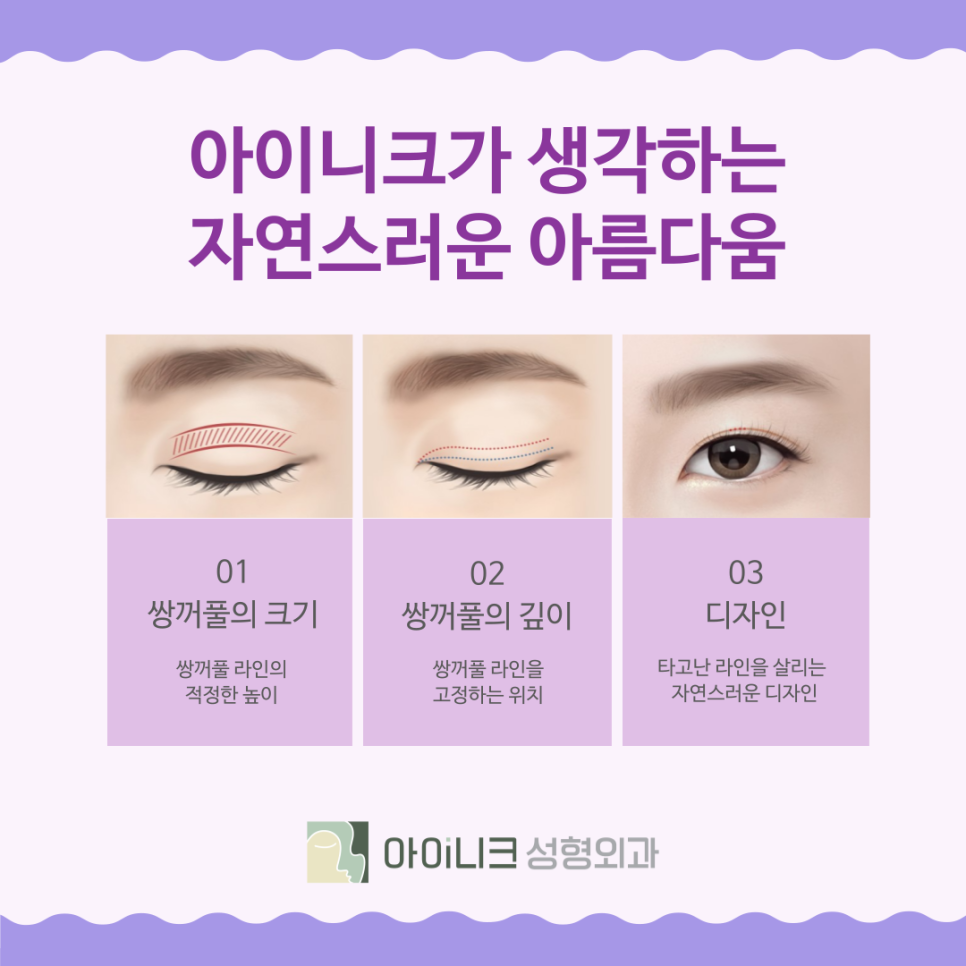 강남눈수술 쌍꺼풀은 자연스러운 디자인이 중요 관련 이미지 4