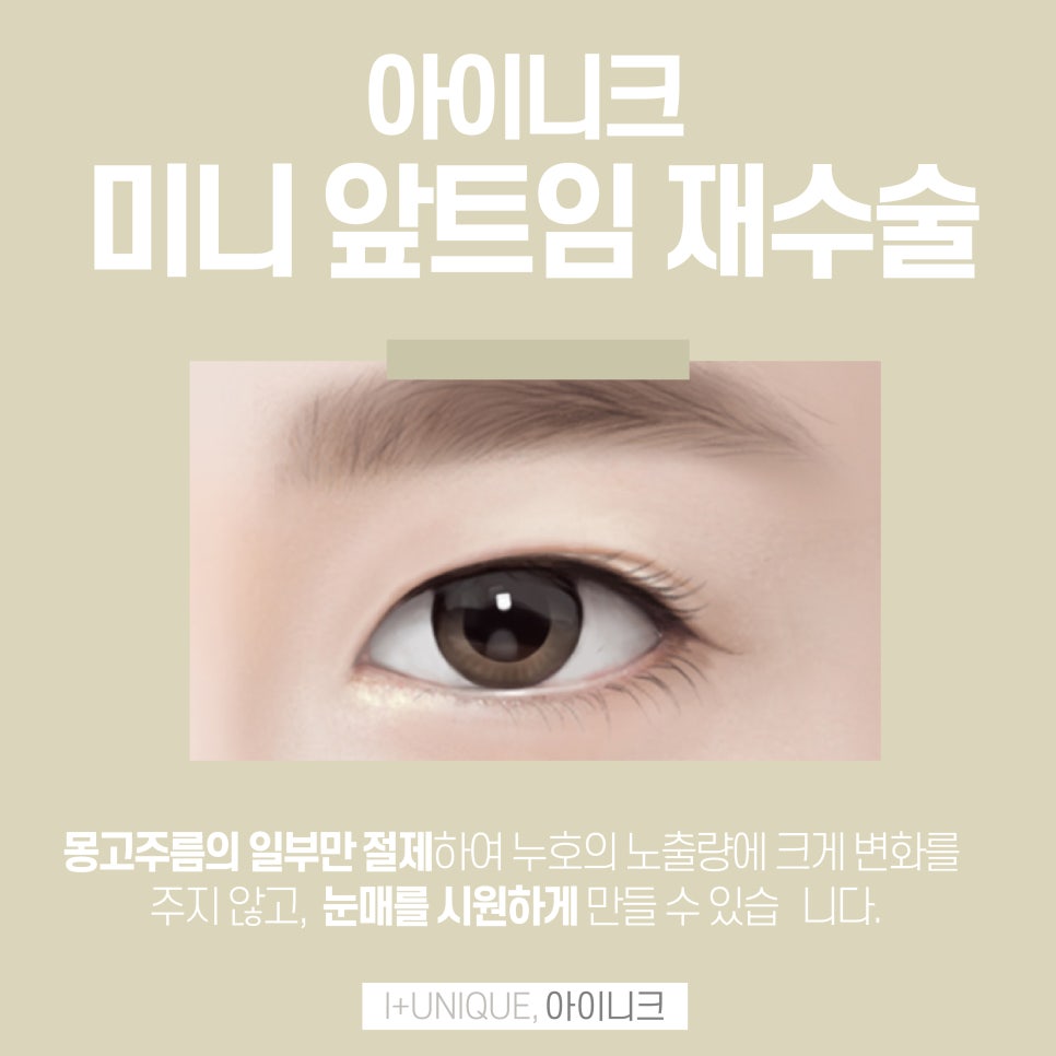 자연스러운 앞트임성형 아이니크성형외과에서 관련 이미지 4