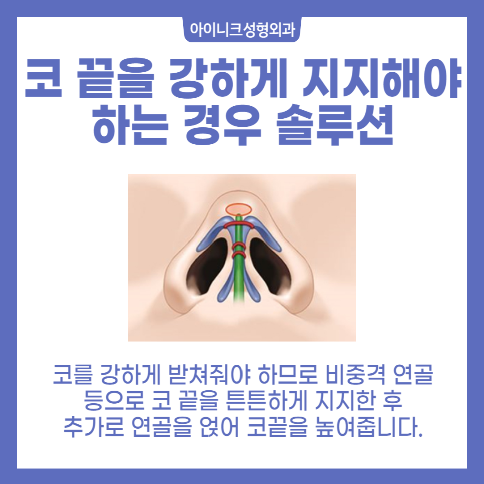 콧대코끝 나만의 디자인을 원한다면? 관련 이미지 4