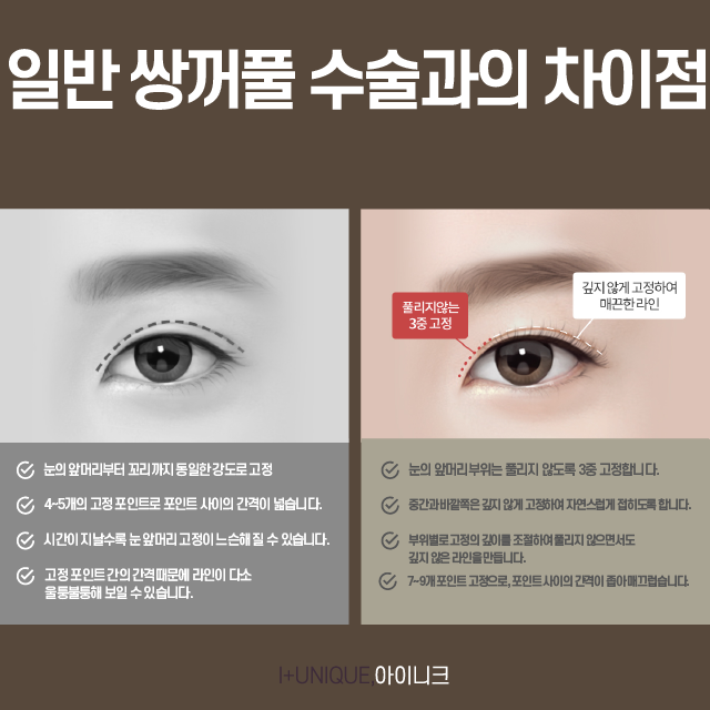 Apgujeong Double Eyelid Surgery Success, Inique’s Unique Technique image 3
