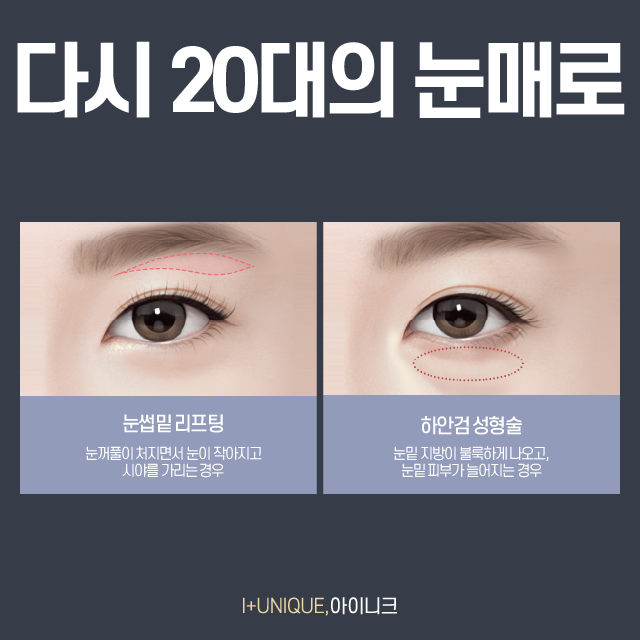 나! 다시 돌아갈래~ 중년 눈 성형, 눈썹거상술 관련 이미지 2