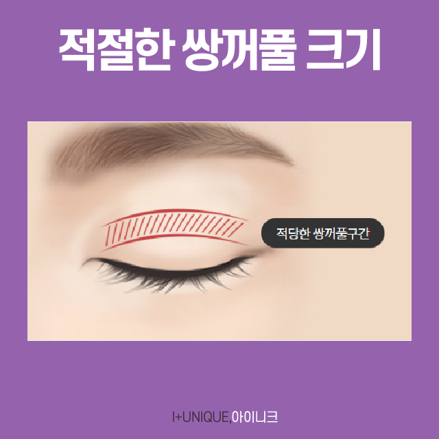 눈재수술유명한곳 제대로 찾는다면? 관련 이미지 3