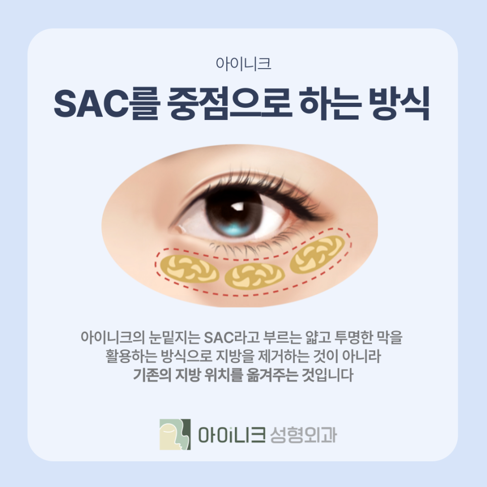 SAC를 중심으로 하는 눈밑지방제거병원의 방식은? 관련 이미지 5