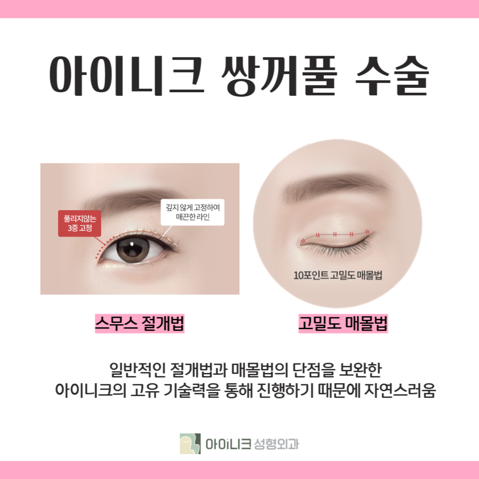 How to Find a Good Double Eyelid Surgery Clinic: Check This! image 5