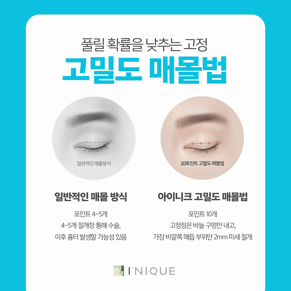 5 Care Tips You Must Follow After Double Eyelid Surgery in Gangnam image 7