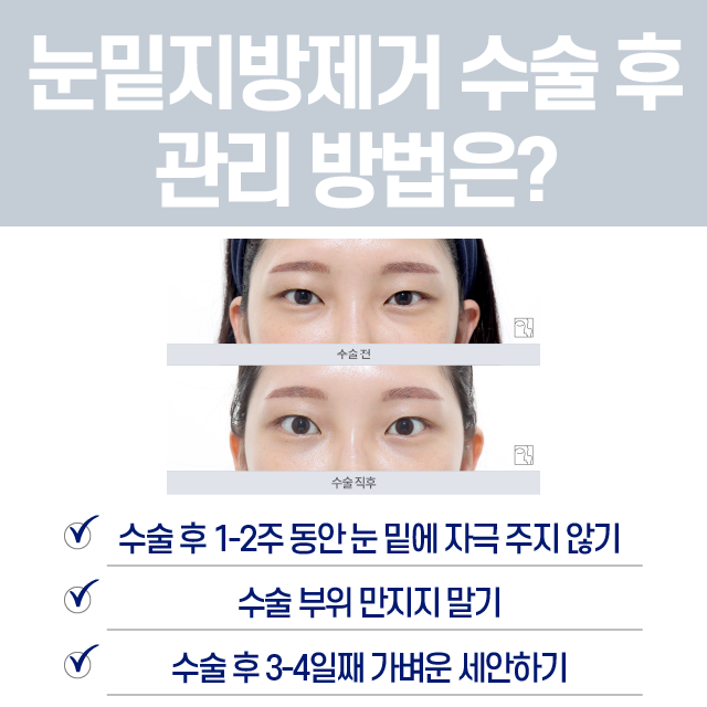 눈밑지방제거 주의사항 및 관리방법 관련 이미지 4